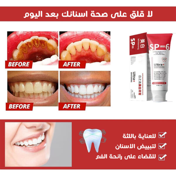 ⁦عرض جهاز تنظيف الاسنان بالالترا ساوند+معجون sp6⁩ - الصورة ⁦2⁩